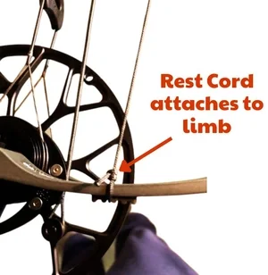 Cord attaches to limb